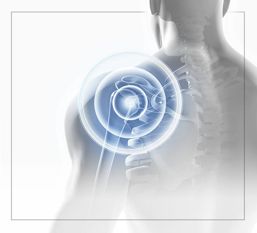 Shoulder Pain