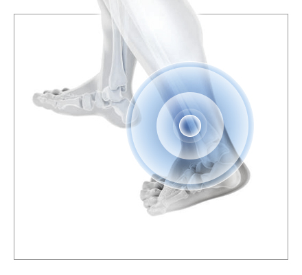 Foot & Ankle Pain
